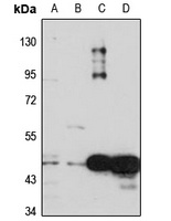 CDSN Rabbit Polyclonal Antibody