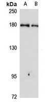 CEMIP Rabbit Polyclonal Antibody