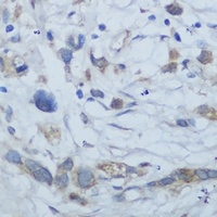 CEMIP Rabbit Polyclonal Antibody