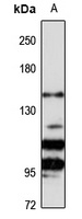 CENPJ Rabbit Polyclonal Antibody