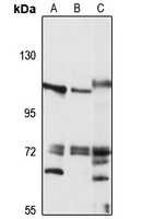 CEP112 Rabbit Polyclonal Antibody