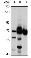 CHFR Rabbit Polyclonal Antibody