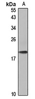 CHIC2 Rabbit Polyclonal Antibody