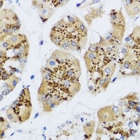 CHIC2 Rabbit Polyclonal Antibody