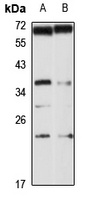 CHMP3 Rabbit Polyclonal Antibody