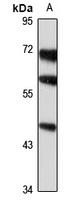 CHST5 Rabbit Polyclonal Antibody