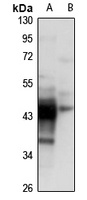 CKMT1A Rabbit Polyclonal Antibody