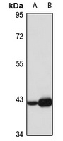 CKMT1B Rabbit Polyclonal Antibody