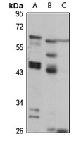 Claudin 18 Rabbit Polyclonal Antibody