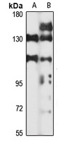 CLEC-16A Rabbit Polyclonal Antibody