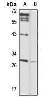 CLEC1B Rabbit Polyclonal Antibody