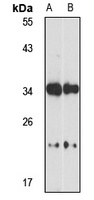 CLN8 Rabbit Polyclonal Antibody