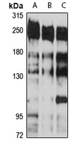 CNOT1 Antibody