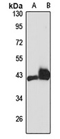 CB2 Rabbit Polyclonal Antibody