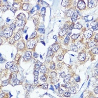 CB2 Rabbit Polyclonal Antibody