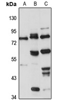 GPBP Rabbit Polyclonal Antibody