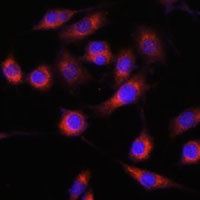 GPBP Rabbit Polyclonal Antibody