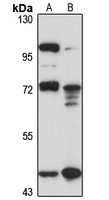 COLGALT2 Antibody