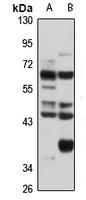 Cornulin Rabbit Polyclonal Antibody