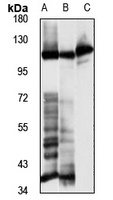 Alpha T-catenin Rabbit Polyclonal Antibody