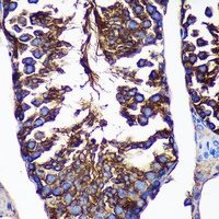 Alpha T-catenin Rabbit Polyclonal Antibody