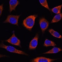 Alpha T-catenin Rabbit Polyclonal Antibody