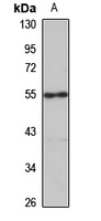 CTU2 Rabbit Polyclonal Antibody