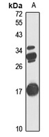 CUTA Rabbit Polyclonal Antibody