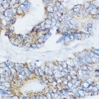 Cytochrome P450 19A1 Rabbit Polyclonal Antibody
