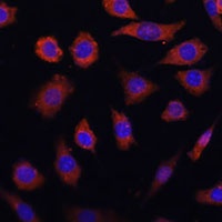 Cytohesin 1 Rabbit Polyclonal Antibody