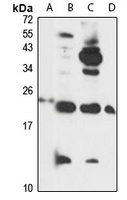 DAD1 Rabbit Polyclonal Antibody