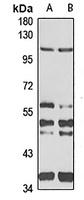 Drebrin Rabbit Polyclonal Antibody