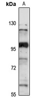 DCAF6 Antibody