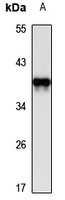 DcpS Rabbit Polyclonal Antibody