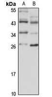DCUN1D1 Rabbit Polyclonal Antibody