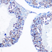 VASA Rabbit Polyclonal Antibody