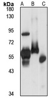 RCK Rabbit Polyclonal Antibody