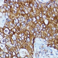 RCK Rabbit Polyclonal Antibody