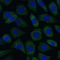 RCK Rabbit Polyclonal Antibody