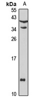 Defensin alpha 3 Rabbit Polyclonal Antibody