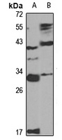 Derlin 1 Rabbit Polyclonal Antibody