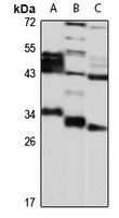 DHRS3 Rabbit Polyclonal Antibody