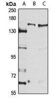 DHX30 Rabbit Polyclonal Antibody