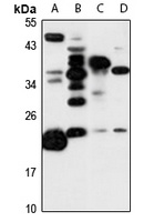 RCL Rabbit Polyclonal Antibody