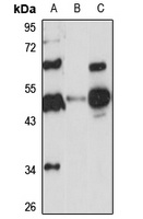 DPEP2 Rabbit Polyclonal Antibody