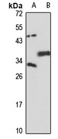 NC2-alpha Rabbit Polyclonal Antibody
