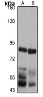 Dystrobrevin alpha Rabbit Polyclonal Antibody
