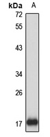 dUTPase Rabbit Polyclonal Antibody