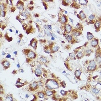 dUTPase Rabbit Polyclonal Antibody