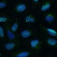 dUTPase Rabbit Polyclonal Antibody